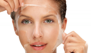 Chemical Peel Services